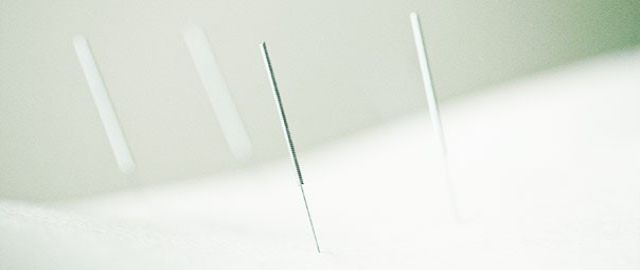 What is Naturopathic Acupuncture?