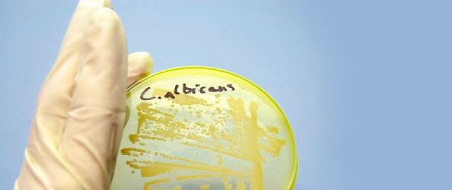 Candida Albicans and Sugar Cravings