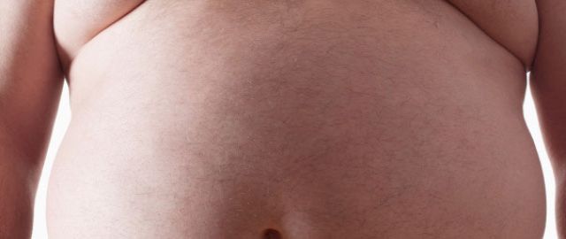 The UK Obesity Crisis