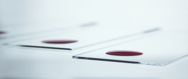 The prevalence of Vitamin B12 deficiency - An interview with Dr Ayan Panja