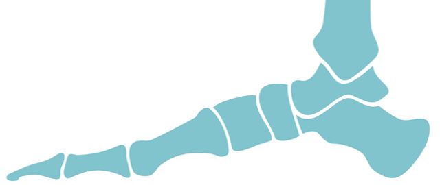 Gout - Signs, symptoms and nutritional support