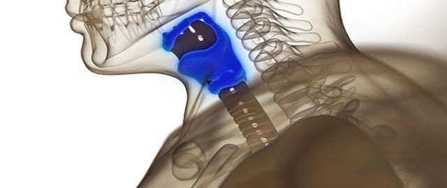 Hypothyroidism - A bigger problem than we think?