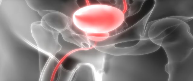 Benign prostate hyperplasia is on the increase – what is it and how may polyphenols help?