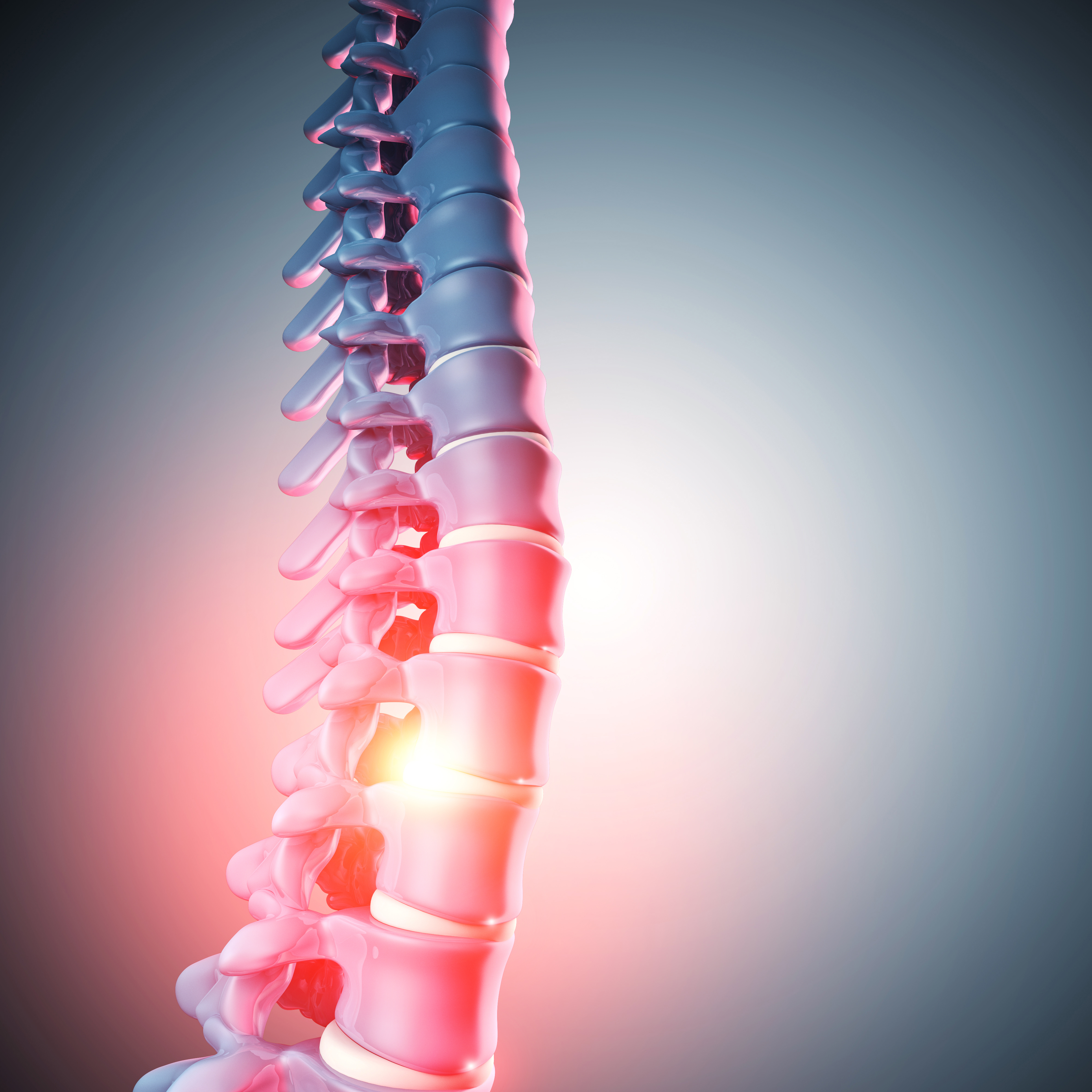 The case for diet as a contributor to non-specific chronic low back pain