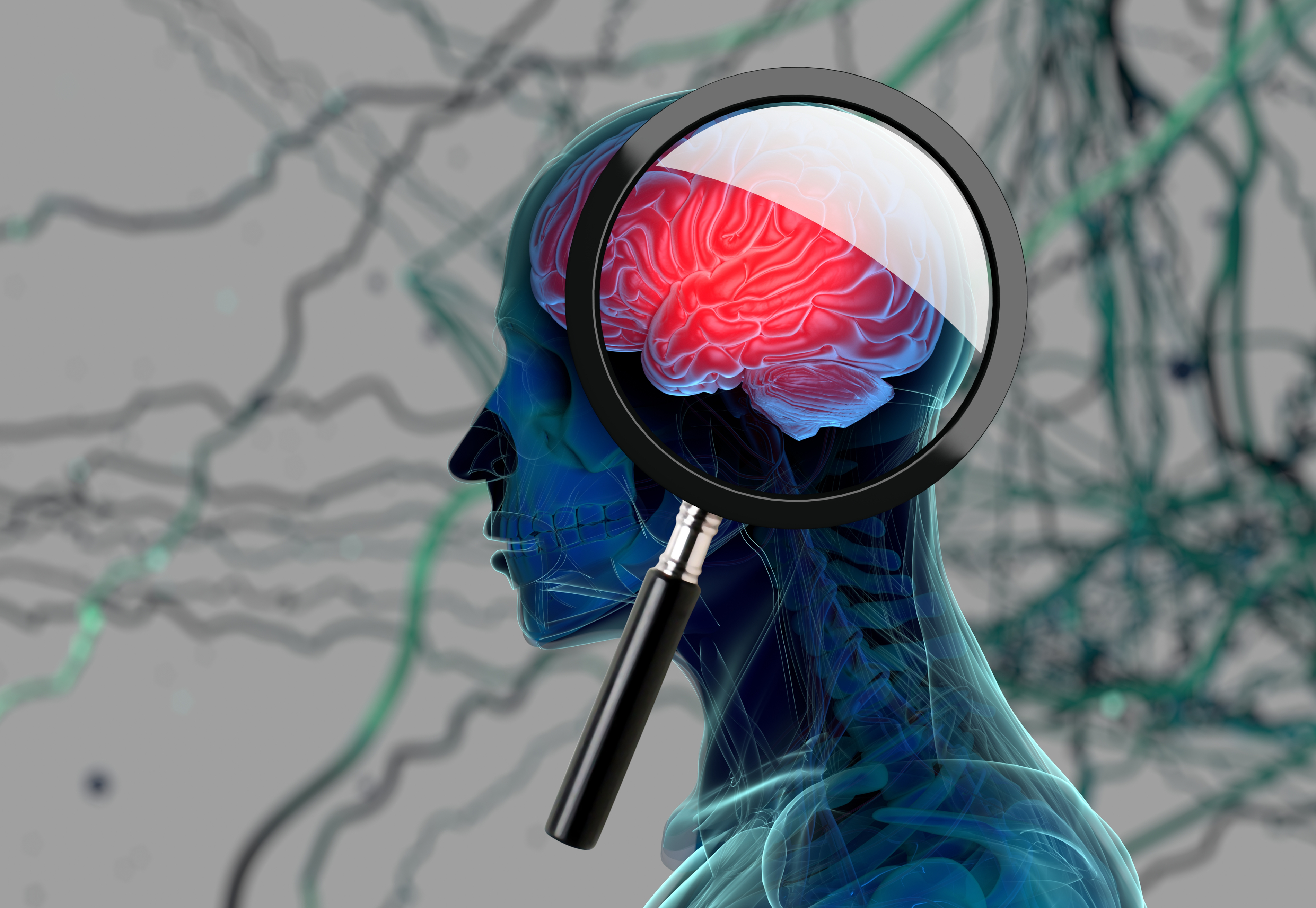 Nutritional Support for Parkinson's Disease